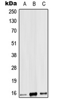 IL9 Antibody - Western blot analysis of IL-9 expression in HEK293T (A); mouse heart (B); rat heart (C) whole cell lysates.
