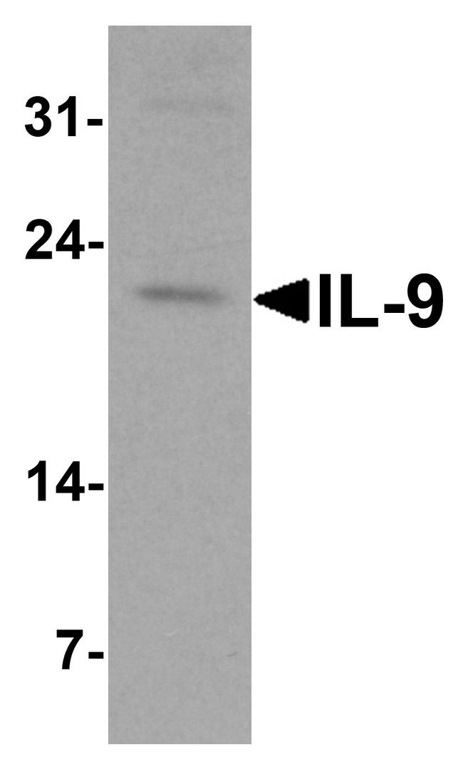 IL9 Antibody - Western blot analysis of IL-9 in human spleen tissue lysate at 1 ug/ml.