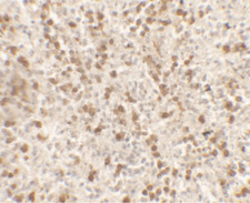IL9 Antibody - Immunohistochemistry of IL-9 in human spleen tissue with IL-9 antibody at 5 ug/ml.