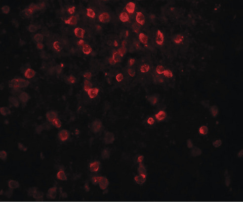 IL9 Antibody - Immunofluorescence of IL-9 in human spleen tissue with IL-9 antibody at 20 ug/ml.
