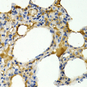 IL9 Antibody - Immunohistochemistry of paraffin-embedded rat lung tissue.