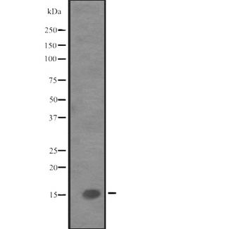 IL9 Antibody - Western blot analysis of IL9 expression in human fetal liver tissue lysate. The lane on the left is treated with the antigen-specific peptide.