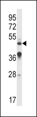 IL9R / CD129 Antibody - IL9R Antibody western blot of A549 cell line lysates (35 ug/lane). The IL9R antibody detected the IL9R protein (arrow).