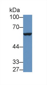 IL9R / CD129 Antibody - Western Blot; Sample: Mouse Placenta lysate; Primary Ab: 1µg/ml Rabbit Anti-Mouse IL9R Antibody Second Ab: 0.2µg/mL HRP-Linked Caprine Anti-Rabbit IgG Polyclonal Antibody