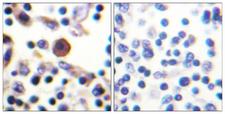 IL9R / CD129 Antibody - Immunohistochemistry analysis of paraffin-embedded human lymph node, using IL-9R Antibody. The picture on the right is blocked with the synthesized peptide.