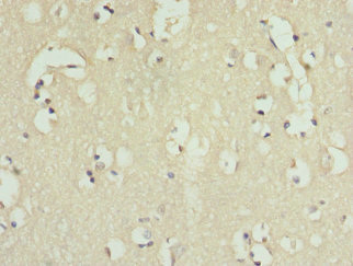 IL9R / CD129 Antibody - Immunohistochemistry of paraffin-embedded human brain tissue at dilution 1:100