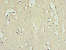 IL9R / CD129 Antibody - Immunohistochemistry of paraffin-embedded human brain tissue at dilution 1:100