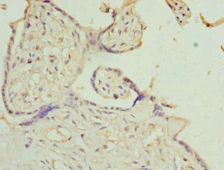 IL9R / CD129 Antibody - Immunohistochemistry of paraffin-embedded human placenta tissue at dilution 1:100