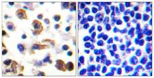 IL9R / CD129 Antibody - Peptide - + Immunohistochemistry analysis of paraffin-embedded human lymph node tissue using IL-9R antibody.