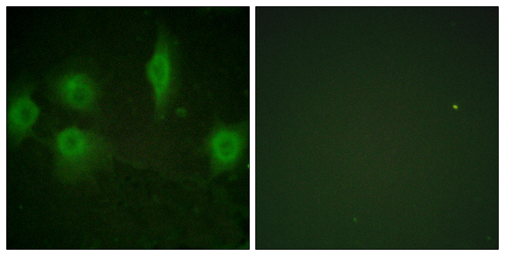 IL9R / CD129 Antibody - Immunofluorescence analysis of HUVEC cells, using IL-9R (Phospho-Ser519) Antibody. The picture on the right is blocked with the phospho peptide.