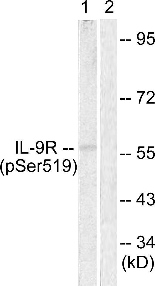 IL9R / CD129 Antibody - Western blot analysis of lysates from HUVEC cells, using IL-9R (Phospho-Ser519) Antibody. The lane on the right is blocked with the phospho peptide.