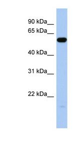 ILDR1 Antibody - ILDR1 antibody Western blot of Fetal Brain lysate. This image was taken for the unconjugated form of this product. Other forms have not been tested.