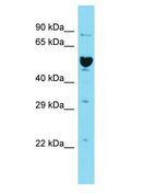ILDR2 Antibody - ILDR2 antibody Western Blot of 721_B. Antibody dilution: 1 ug/ml.  This image was taken for the unconjugated form of this product. Other forms have not been tested.