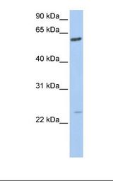 ILEI / FAM3C Antibody - 721_B cell lysate. Antibody concentration: 1.0 ug/ml. Gel concentration: 12%.  This image was taken for the unconjugated form of this product. Other forms have not been tested.