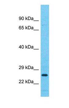 ILEI / FAM3C Antibody - Western blot of FAM3C Antibody with human 786-0 Whole Cell lysate.  This image was taken for the unconjugated form of this product. Other forms have not been tested.