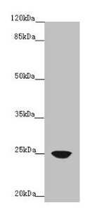ILEI / FAM3C Antibody - Western blot All lanes: FAM3C antibody at 4µg/ml + A431 whole cell lysate Secondary Goat polyclonal to rabbit IgG at 1/10000 dilution Predicted band size: 25 kDa Observed band size: 25 kDa