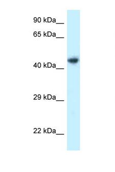 ILKAP Antibody - ILKAP antibody Western blot of 721_B Cell lysate. Antibody concentration 1 ug/ml.  This image was taken for the unconjugated form of this product. Other forms have not been tested.
