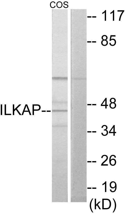 ILKAP Antibody - Western blot analysis of lysates from COS7 cells, using ILKAP Antibody. The lane on the right is blocked with the synthesized peptide.