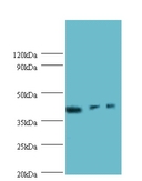 ILKAP Antibody - Western blot of Transcription initiation factor IIB antibody at 2 ug/ml lane 1: rat kidney tissue. lane 2: U251 whole cell lysate. Lane 3: mouse stomach tissue. Secondary: Goat polyclonal to Rabbit IgG at 1:10000 dilution. Predicted band size: 43.  This image was taken for the unconjugated form of this product. Other forms have not been tested.