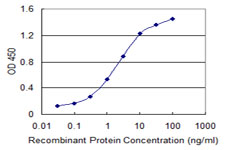 ILKAP Antibody - Detection limit for recombinant GST tagged ILKAP is 0.03 ng/ml as a capture antibody.