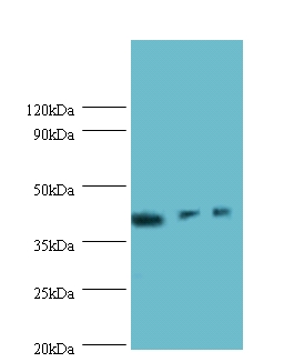 ILKAP Antibody - Western blot of Transcription initiation factor IIB antibody at 2 ug/ml lane 1: rat kidney tissue. lane 2: U251 whole cell lysate. Lane 3: mouse stomach tissue. Secondary: Goat polyclonal to Rabbit IgG at 1:10000 dilution. Predicted band size: 43.  This image was taken for the unconjugated form of this product. Other forms have not been tested.