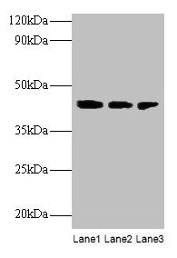 ILKAP Antibody - Western blot All lanes: Transcription initiation factor IIB antibody at 2µg/ml Lane 1: Rat kidney tissue Lane 2: U251 whole cell lysate Lane 3: Mouse stomach tissue Secondary Goat polyclonal to rabbit IgG at 1/10000 dilution Predicted band size: 43 kDa Observed band size: 43 kDa