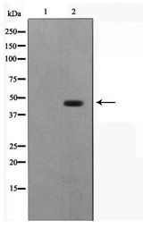 ILKAP Antibody - Western blot of COS7 cell lysate using ILKAP Antibody