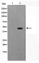 ILKAP Antibody - Western blot of COS7 cell lysate using ILKAP Antibody