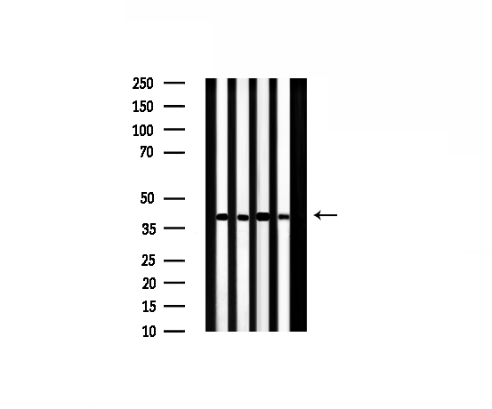 ILKAP Antibody - Western blot analysis of ILKAP expression in various lysates