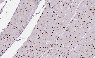 ILKAP Antibody - 1:100 staining human Smooth muscle tissue by IHC-P. The tissue was formaldehyde fixed and a heat mediated antigen retrieval step in citrate buffer was performed. The tissue was then blocked and incubated with the antibody for 1.5 hours at 22°C. An HRP conjugated goat anti-rabbit antibody was used as the secondary.