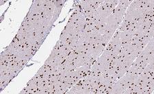 ILKAP Antibody - 1:100 staining human Smooth muscle tissue by IHC-P. The tissue was formaldehyde fixed and a heat mediated antigen retrieval step in citrate buffer was performed. The tissue was then blocked and incubated with the antibody for 1.5 hours at 22°C. An HRP conjugated goat anti-rabbit antibody was used as the secondary.