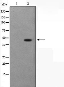 ILKAP Antibody - Western blot analysis on COS7 cell lysates using ILKAP antibody. The lane on the left is treated with the antigen-specific peptide.