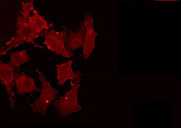 ILKAP Antibody - Staining HeLa cells by IF/ICC. The samples were fixed with PFA and permeabilized in 0.1% Triton X-100, then blocked in 10% serum for 45 min at 25°C. The primary antibody was diluted at 1:200 and incubated with the sample for 1 hour at 37°C. An Alexa Fluor 594 conjugated goat anti-rabbit IgG (H+L) Ab, diluted at 1/600, was used as the secondary antibody.