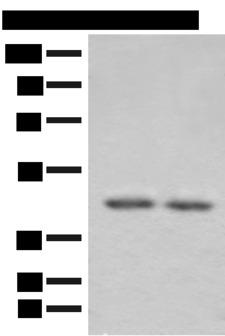 ILKAP Antibody - Western blot analysis of 293T cell lysates  using ILKAP Polyclonal Antibody at dilution of 1:800