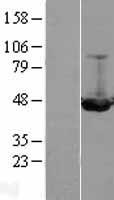 ILKAP Protein - Western validation with an anti-DDK antibody * L: Control HEK293 lysate R: Over-expression lysate
