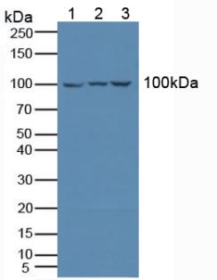 ILT2 / CD85 Antibody - Western Blot; Sample: Lane1: Human Jurkat Cells; Lane2: Human K562 Cells; Lane3: Human Raji Cells.