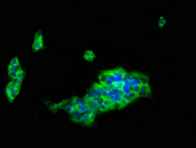 ILT2 / CD85 Antibody - Immunofluorescence staining of 293 cells at a dilution of 1:133, counter-stained with DAPI. The cells were fixed in 4% formaldehyde, permeabilized using 0.2% Triton X-100 and blocked in 10% normal Goat Serum. The cells were then incubated with the antibody overnight at 4 °C.The secondary antibody was Alexa Fluor 488-congugated AffiniPure Goat Anti-Rabbit IgG (H+L) .