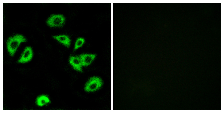ILT3 / LILRB4 Antibody - Immunofluorescence analysis of A549 cells, using LILRB4 Antibody. The picture on the right is blocked with the synthesized peptide.