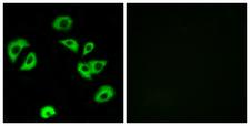 ILT3 / LILRB4 Antibody - Immunofluorescence analysis of A549 cells, using LILRB4 Antibody. The picture on the right is blocked with the synthesized peptide.