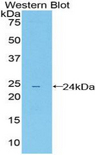 ILT3 / LILRB4 Antibody - Western blot of recombinant ILT3 / LILRB4.  This image was taken for the unconjugated form of this product. Other forms have not been tested.