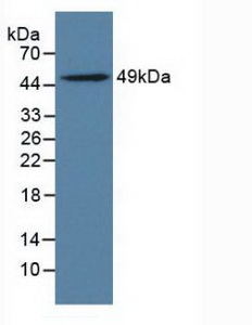 ILT3 / LILRB4 Antibody - Western Blot; Sample: Rat Adrenal Gland Tissue.