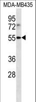 ILT3 / LILRB4 Antibody - LILRB4 Antibody western blot of MDA-MB435 cell line lysates (35 ug/lane). The LILRB4 antibody detected the LILRB4 protein (arrow).