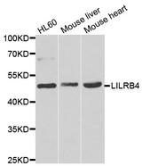 ILT3 / LILRB4 Antibody - Western blot of extracts of various cell lines, using LILRB4 antibody.