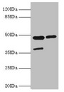 ILT3 / LILRB4 Antibody - Western blot All Lanes:LILRB4 antibody at 4.39ug/ml Lane 1:MCF-7 whole cell lysate Lane 2:A549 whole cell lysate Secondary Goat polyclonal to rabbit at 1/10000 dilution Predicted band size: 49kDa Observed band size: 49kDa,40kDa (We are unsure as to the identity of this extra band)
