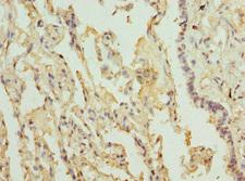 ILT3 / LILRB4 Antibody - Immunohistochemistry of paraffin-embedded human lung tissue at dilution 1:100