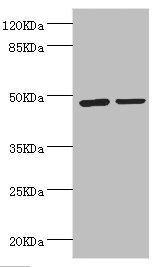 ILT3 / LILRB4 Antibody - Western blot All Lanes:LILRB4 antibody at 3.45ug/ml Lane 1:MCF-7 whole cell lysate Lane 2:A549 whole cell lysate Secondary Goat polyclonal to rabbit at 1/10000 dilution Predicted band size: 49kDa Observed band size: 49kDa