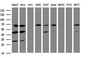 ILVBL Antibody - Western blot of extracts (35 ug) from 9 different cell lines by using g anti-ILVBL monoclonal antibody (HepG2: human; HeLa: human; SVT2: mouse; A549: human; COS7: monkey; Jurkat: human; MDCK: canine; PC12: rat; MCF7: human).