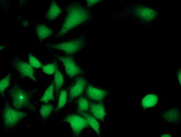 ILVBL Antibody - Immunofluorescent staining of HeLa cells using anti-ILVBL mouse monoclonal antibody.