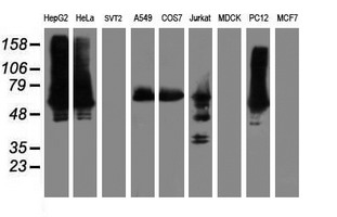 ILVBL Antibody - Western blot of extracts (35 ug) from 9 different cell lines by using anti-ILVBL monoclonal antibody.