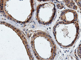 ILVBL Antibody - IHC of paraffin-embedded Human breast tissue using anti-ILVBL mouse monoclonal antibody.